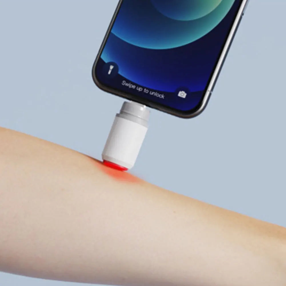 Mosquito Bite Pen Insect Bite Healer Anti-Itch Pen